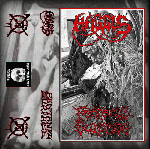 Haggus : Haggus - Fentanyl Surprise